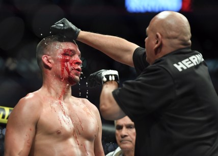 Nov 2, 2019; New York, NY, USA; Nate Diaz (blue gloves) gets treatment during his fight against Jorge Masvidal (red gloves) during UFC 244 at Madison Square Garden. Mandatory Credit: Sarah Stier-USA TODAY Sports