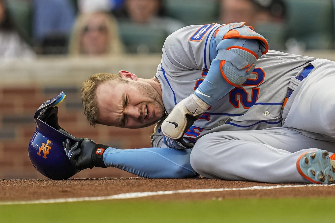 Jun 7, 2023; Cumberland, Georgia, USA; New York Mets first baseman Pete Alonso (20) reacts after being hit by a pitch against the Atlanta Braves during the first inning at Truist Park. Mandatory Credit: Dale Zanine-USA TODAY Sports
